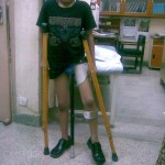 abduction brace for Perthe`s  disease